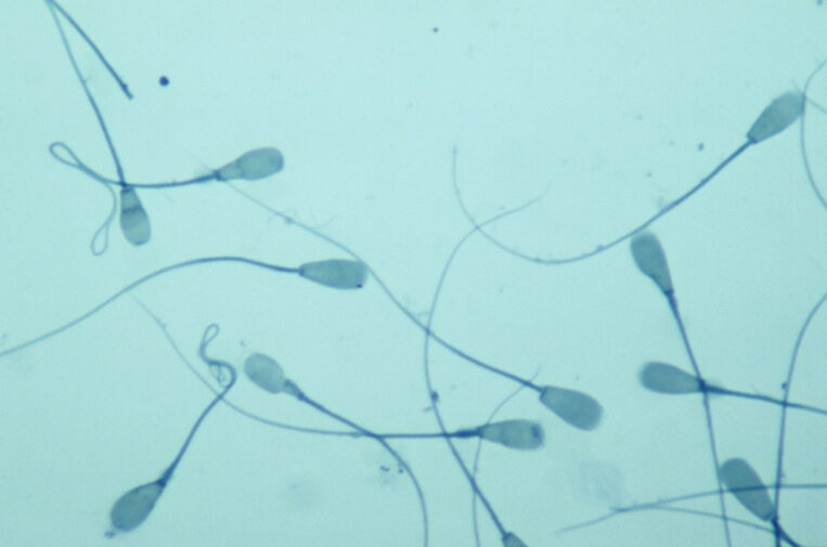 Azoospermia: sperm retrieval techniques