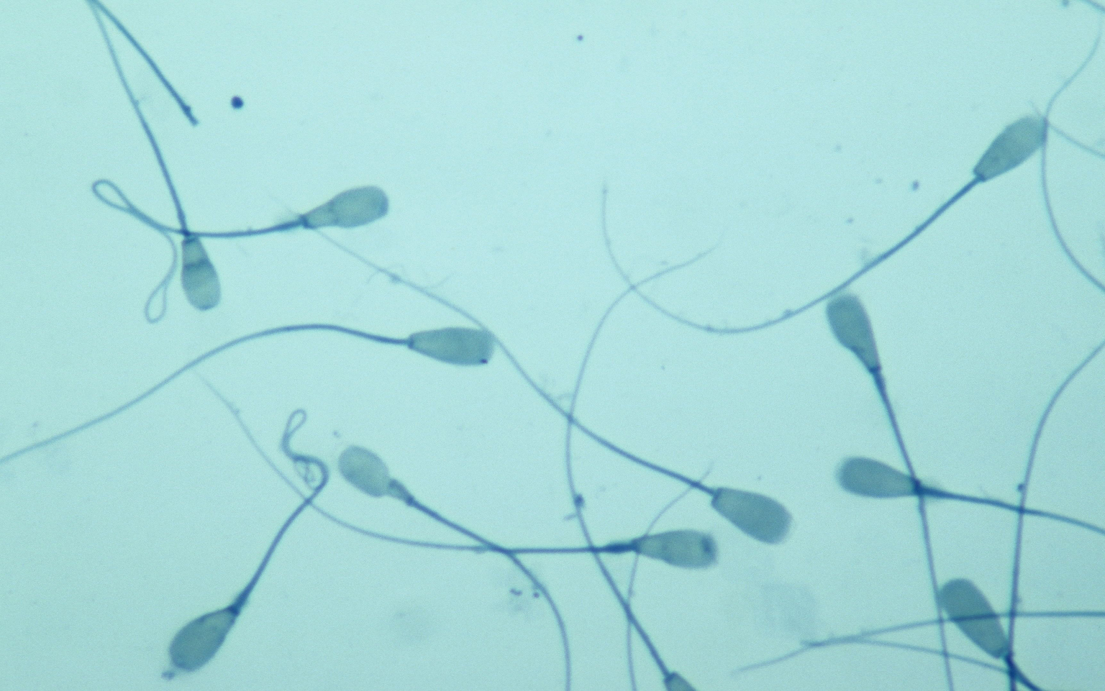 Azoospermia: sperm retrieval techniques